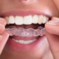 How Nightguards Can Save Your Teeth from Grinding