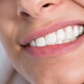 Treatment Options for Sensitive Teeth: What You Need to Know