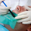 Understanding the Procedure for Root Canal Therapy