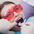 The Benefits of Fluoride Treatments for Preventative Dental Care