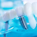 Exploring the Different Types of Dental Implants
