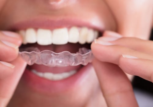 How Nightguards Can Save Your Teeth from Grinding