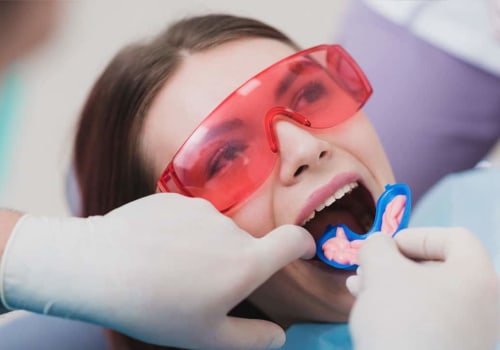 The Benefits of Fluoride Treatments for Preventative Dental Care