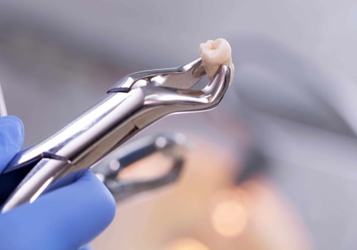 Recovery and Aftercare: What You Need to Know After Wisdom Tooth Extraction