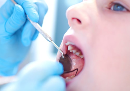 How to Detect and Prevent Cavities for Optimal Dental Health